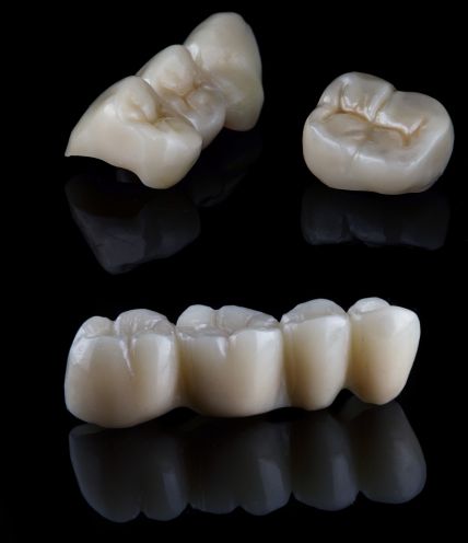 Dental Crowns and Bridges