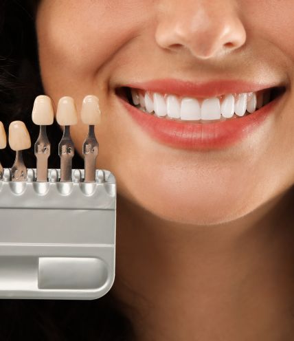 Porcelain Veneers