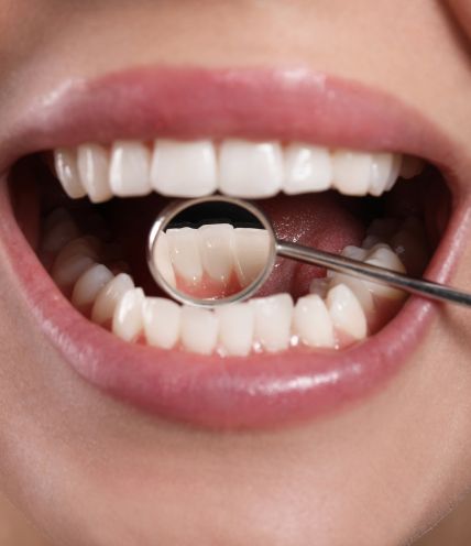 Periodontal Treatment