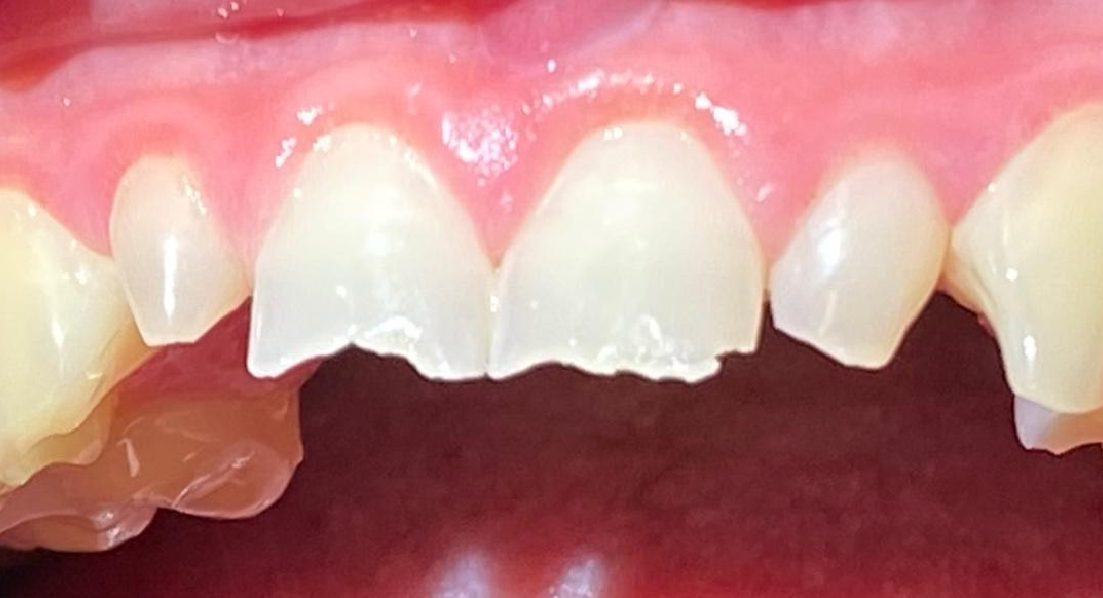 Before